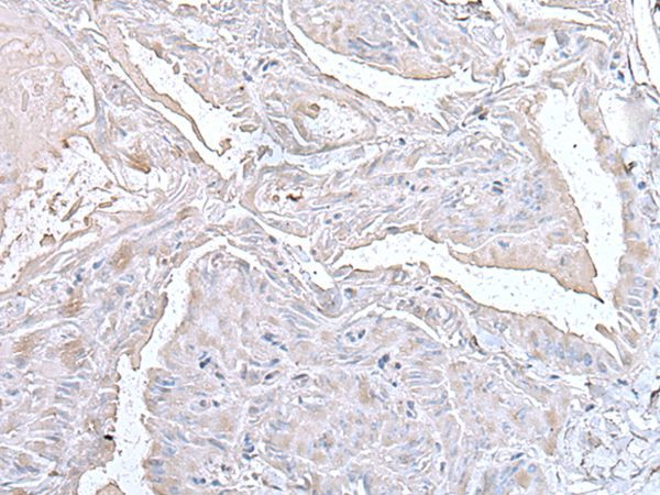 PRL1 Antibody in Immunohistochemistry (Paraffin) (IHC (P))