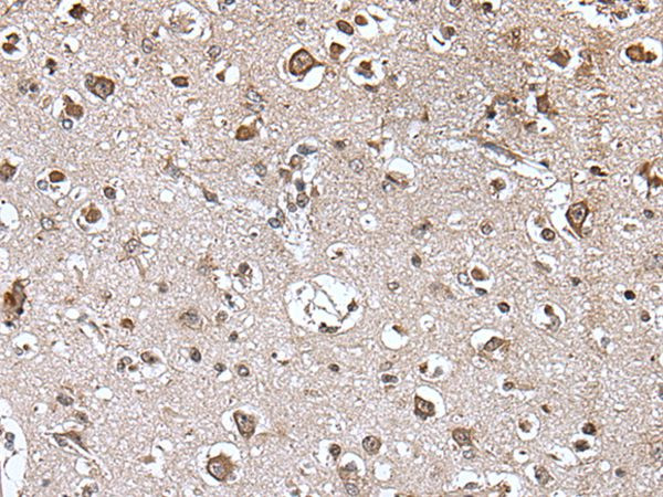 TRIM27 Antibody in Immunohistochemistry (Paraffin) (IHC (P))