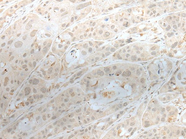 ZNF238 Antibody in Immunohistochemistry (Paraffin) (IHC (P))