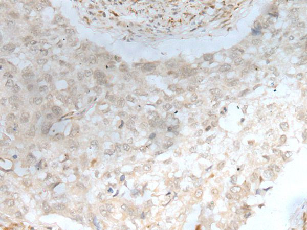 ZNF238 Antibody in Immunohistochemistry (Paraffin) (IHC (P))