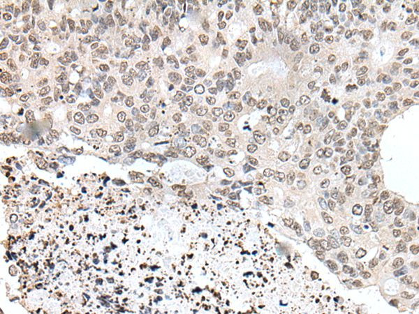 YPEL1 Antibody in Immunohistochemistry (Paraffin) (IHC (P))