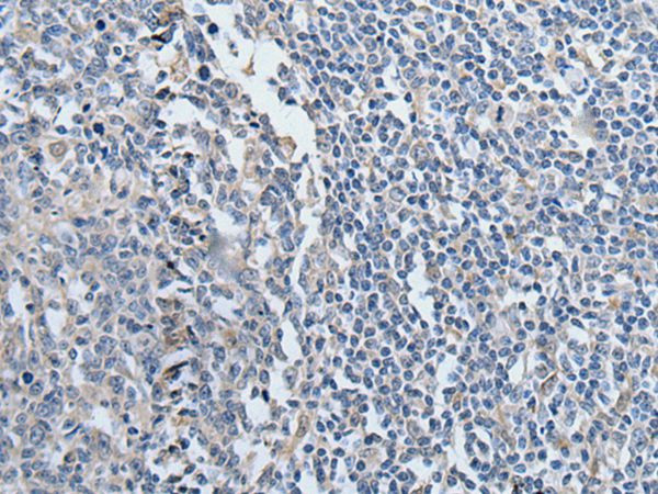 YPEL2 Antibody in Immunohistochemistry (Paraffin) (IHC (P))