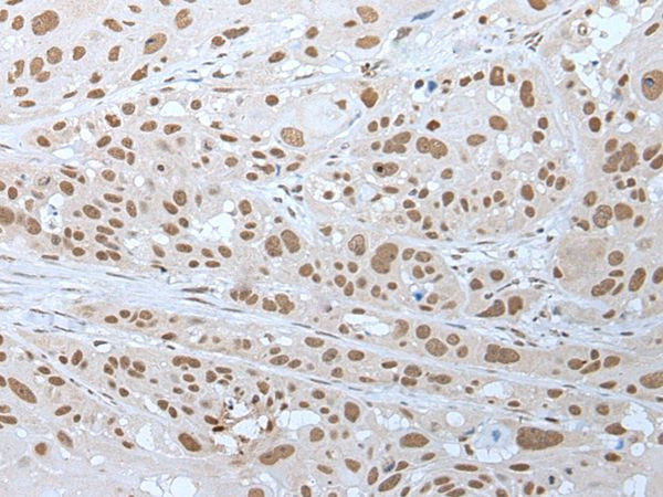 WHSC2 Antibody in Immunohistochemistry (Paraffin) (IHC (P))