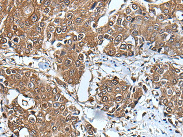 UBE2D3 Antibody in Immunohistochemistry (Paraffin) (IHC (P))