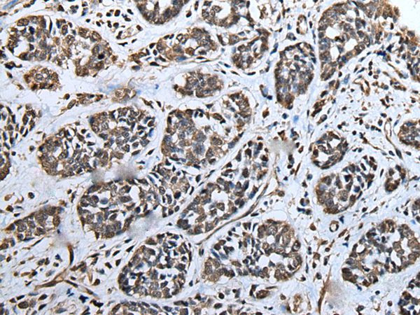 ATAD1 Antibody in Immunohistochemistry (Paraffin) (IHC (P))