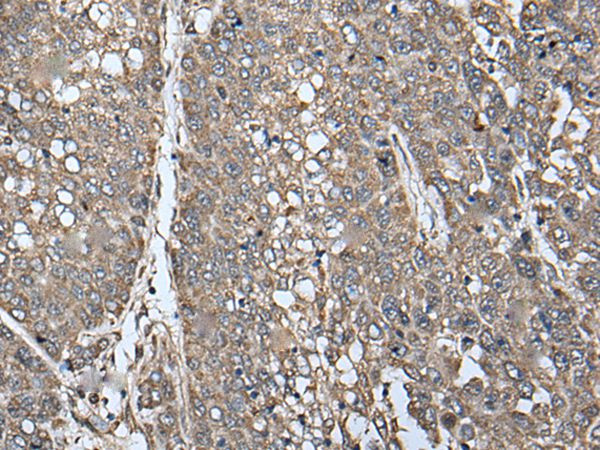 ATAD1 Antibody in Immunohistochemistry (Paraffin) (IHC (P))