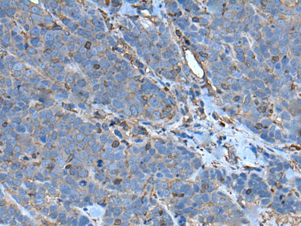 SLC24A5 Antibody in Immunohistochemistry (Paraffin) (IHC (P))