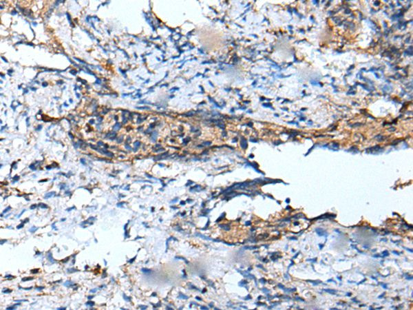 DEFB104A Antibody in Immunohistochemistry (Paraffin) (IHC (P))