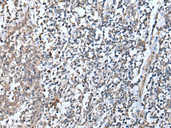 DEFB104A Antibody in Immunohistochemistry (Paraffin) (IHC (P))