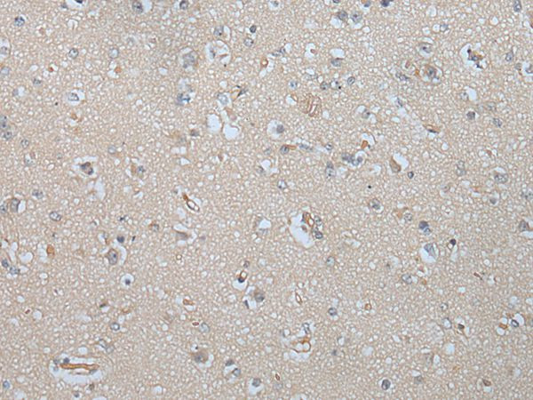 MAGEB5 Antibody in Immunohistochemistry (Paraffin) (IHC (P))