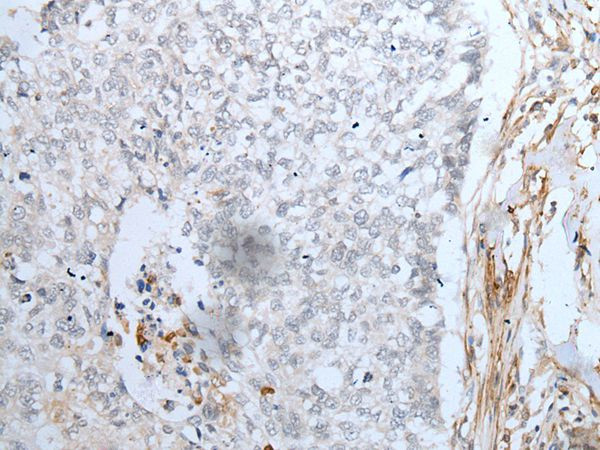 MAGEB5 Antibody in Immunohistochemistry (Paraffin) (IHC (P))