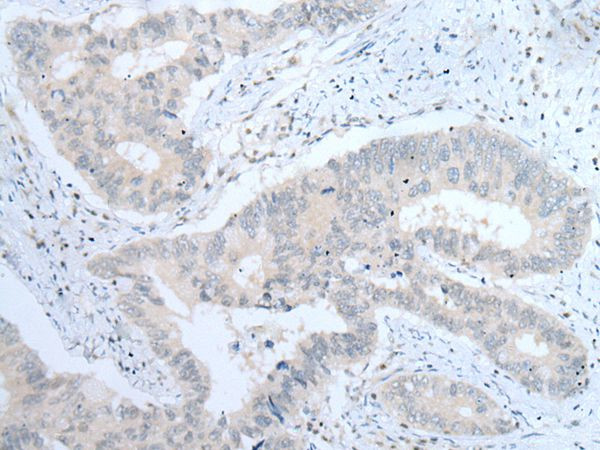 ITGA8 Antibody in Immunohistochemistry (Paraffin) (IHC (P))