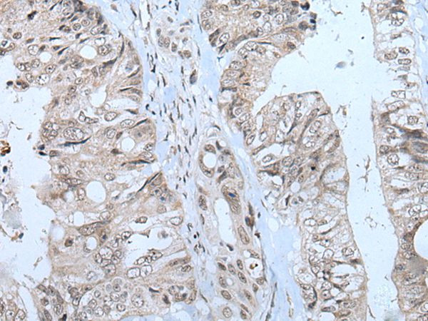 MTHFR Antibody in Immunohistochemistry (Paraffin) (IHC (P))