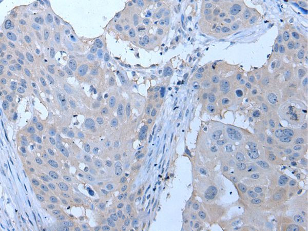 YPEL4 Antibody in Immunohistochemistry (Paraffin) (IHC (P))