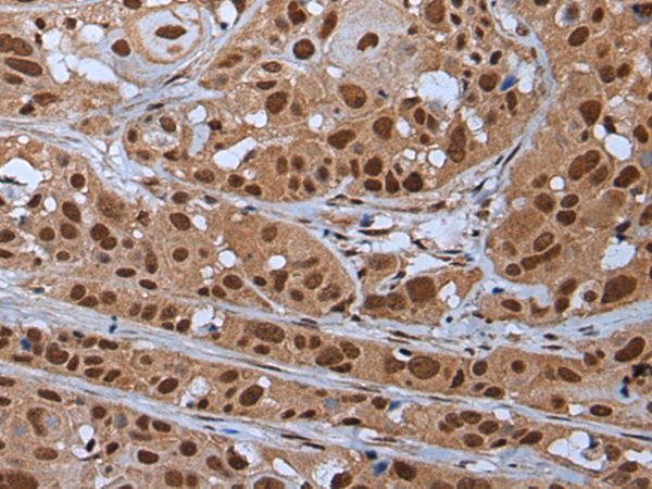 YY2 Antibody in Immunohistochemistry (Paraffin) (IHC (P))