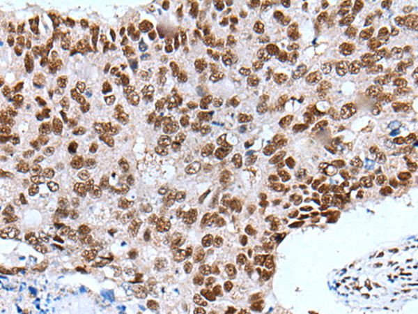 XAB2 Antibody in Immunohistochemistry (Paraffin) (IHC (P))