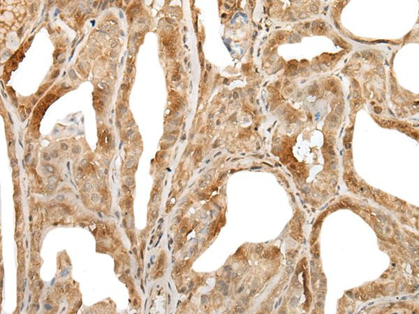 ZUFSP Antibody in Immunohistochemistry (Paraffin) (IHC (P))