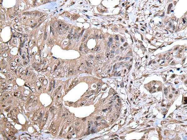 Zyxin Antibody in Immunohistochemistry (Paraffin) (IHC (P))