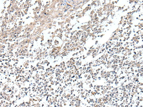 VGLL2 Antibody in Immunohistochemistry (Paraffin) (IHC (P))