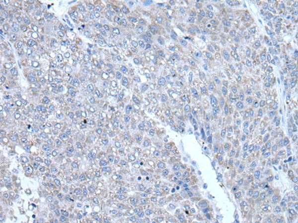 RAC2 Antibody in Immunohistochemistry (Paraffin) (IHC (P))