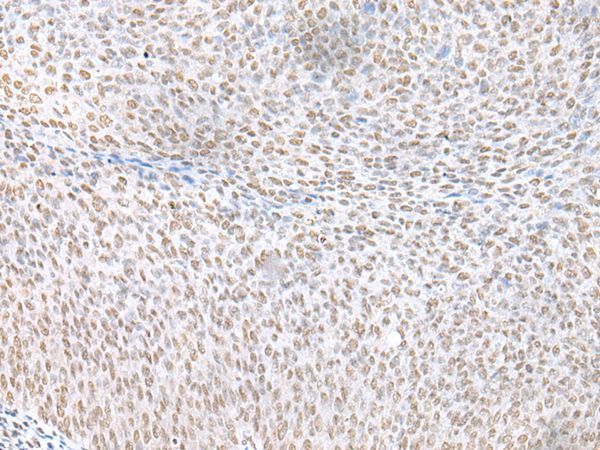 ECT2 Antibody in Immunohistochemistry (Paraffin) (IHC (P))