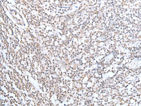 ECT2 Antibody in Immunohistochemistry (Paraffin) (IHC (P))