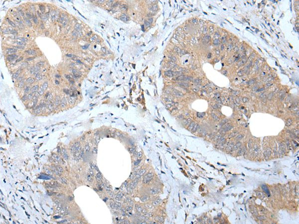 MATN2 Antibody in Immunohistochemistry (Paraffin) (IHC (P))