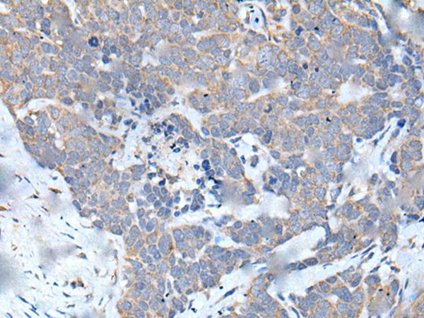 MATN2 Antibody in Immunohistochemistry (Paraffin) (IHC (P))