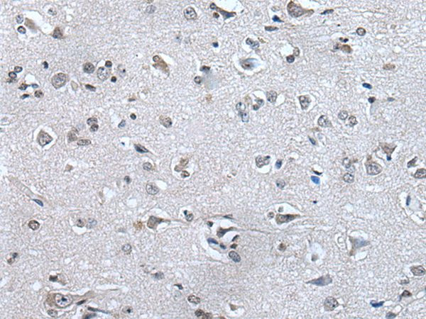 HAND1 Antibody in Immunohistochemistry (Paraffin) (IHC (P))