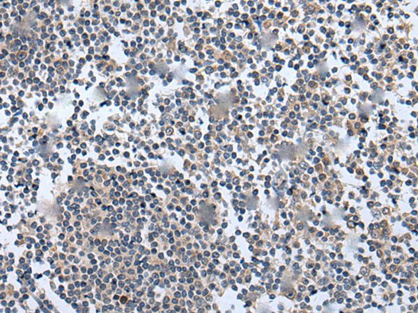 WNT5A Antibody in Immunohistochemistry (Paraffin) (IHC (P))