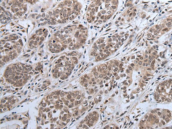 IWS1 Antibody in Immunohistochemistry (Paraffin) (IHC (P))