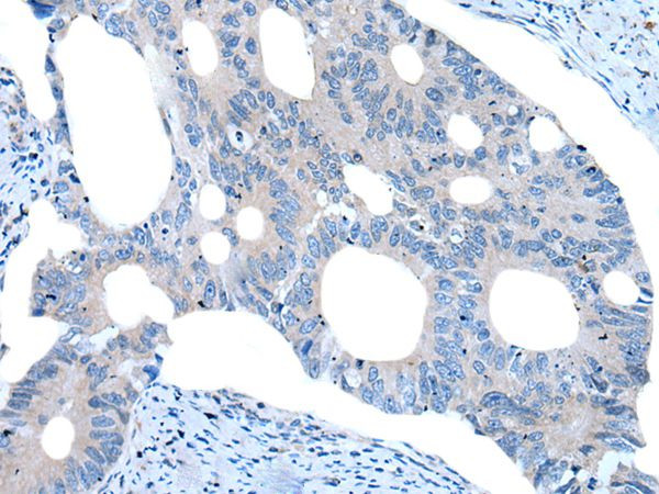 UNC5B Antibody in Immunohistochemistry (Paraffin) (IHC (P))