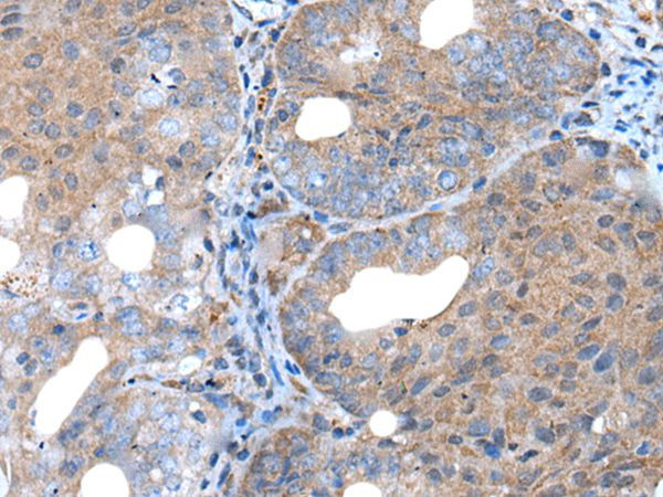 UNC5B Antibody in Immunohistochemistry (Paraffin) (IHC (P))