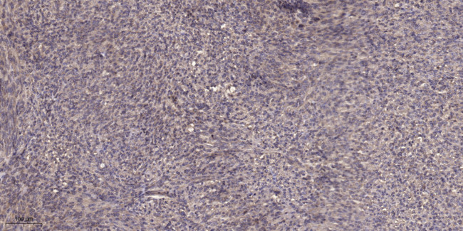 TBL2 Antibody in Immunohistochemistry (Paraffin) (IHC (P))