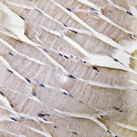 Defensin alpha-3 Antibody in Immunohistochemistry (Paraffin) (IHC (P))