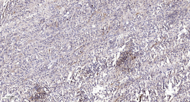 RAB1B Antibody in Immunohistochemistry (Paraffin) (IHC (P))