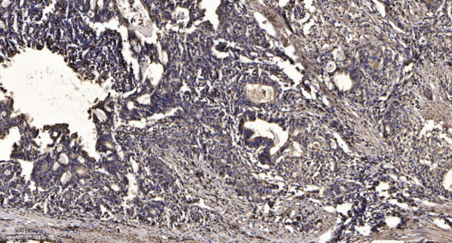 STK38L Antibody in Immunohistochemistry (Paraffin) (IHC (P))