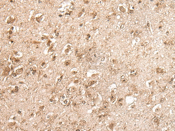 C12orf10 Antibody in Immunohistochemistry (Paraffin) (IHC (P))