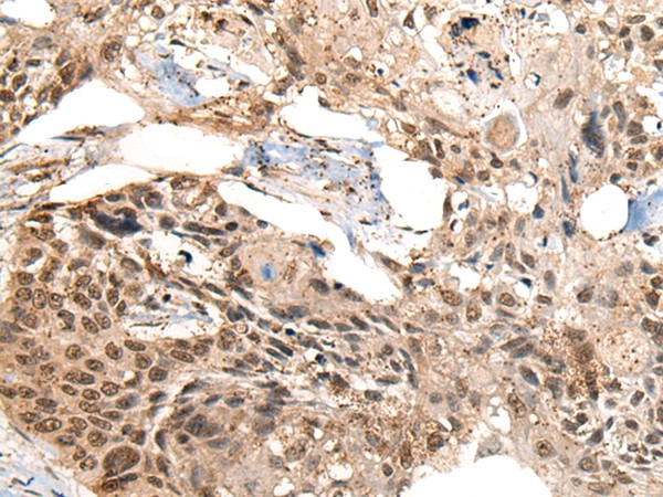 C12orf10 Antibody in Immunohistochemistry (Paraffin) (IHC (P))