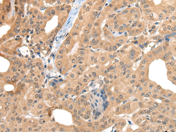 CA7 Antibody in Immunohistochemistry (Paraffin) (IHC (P))