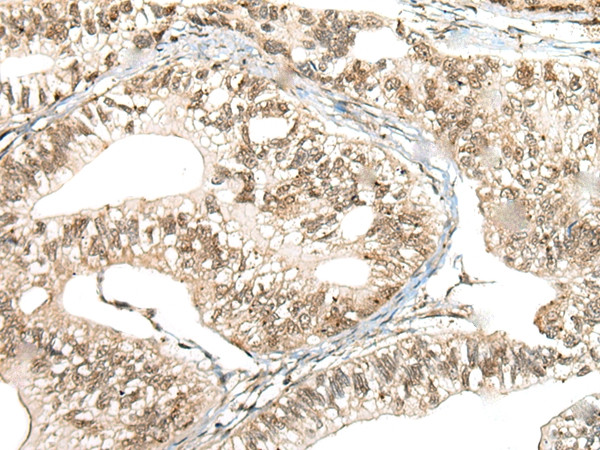 CCNK Antibody in Immunohistochemistry (Paraffin) (IHC (P))