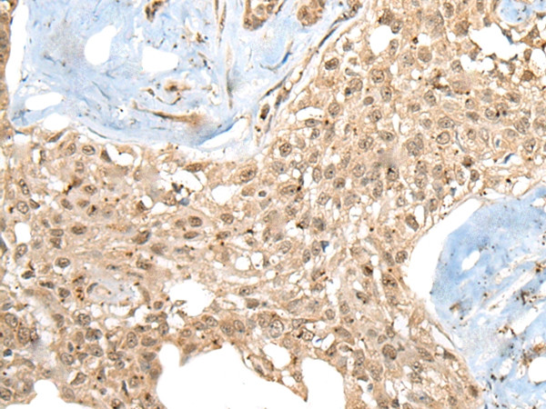 CCNK Antibody in Immunohistochemistry (Paraffin) (IHC (P))