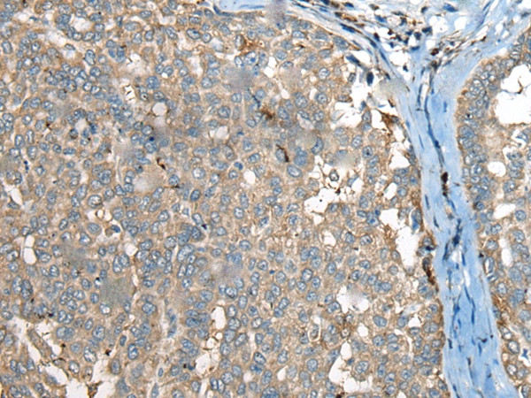 CCT6B Antibody in Immunohistochemistry (Paraffin) (IHC (P))