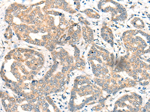 CDK2AP1 Antibody in Immunohistochemistry (Paraffin) (IHC (P))