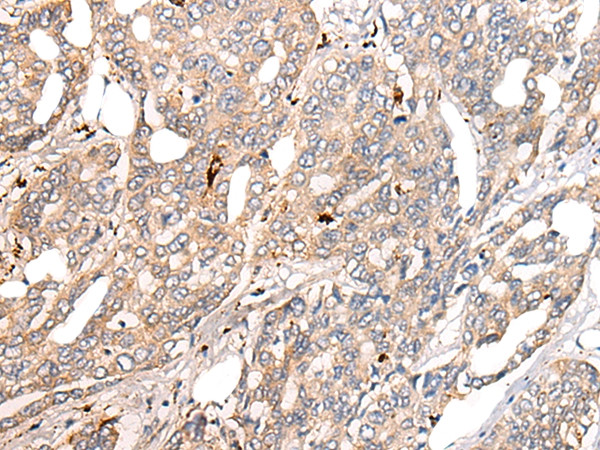 COL11A1 Antibody in Immunohistochemistry (Paraffin) (IHC (P))