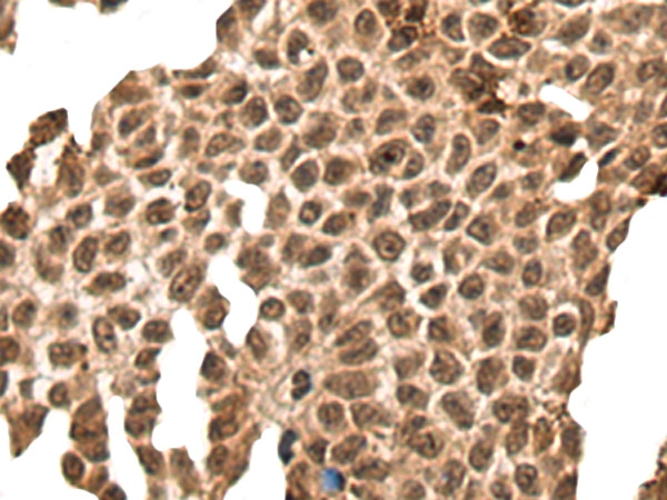 L1RE1 Antibody in Immunohistochemistry (Paraffin) (IHC (P))