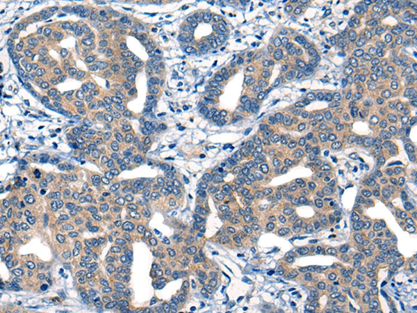 MIIP Antibody in Immunohistochemistry (Paraffin) (IHC (P))