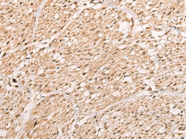 WBP5 Antibody in Immunohistochemistry (Paraffin) (IHC (P))