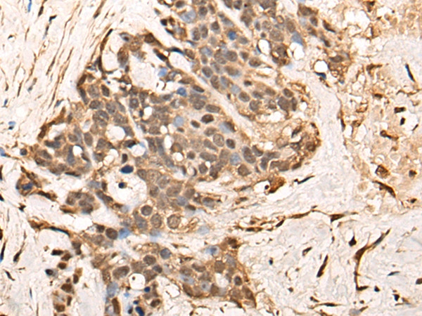 WBP5 Antibody in Immunohistochemistry (Paraffin) (IHC (P))