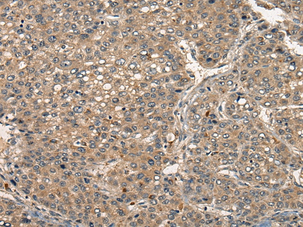 CD153 Antibody in Immunohistochemistry (Paraffin) (IHC (P))